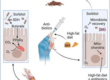 dieta y antibioticos con intolerancia al sorbitol